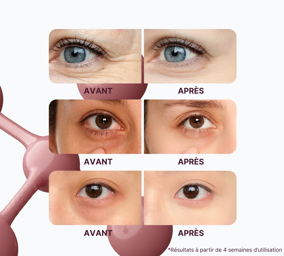 EYESCULPT PRO