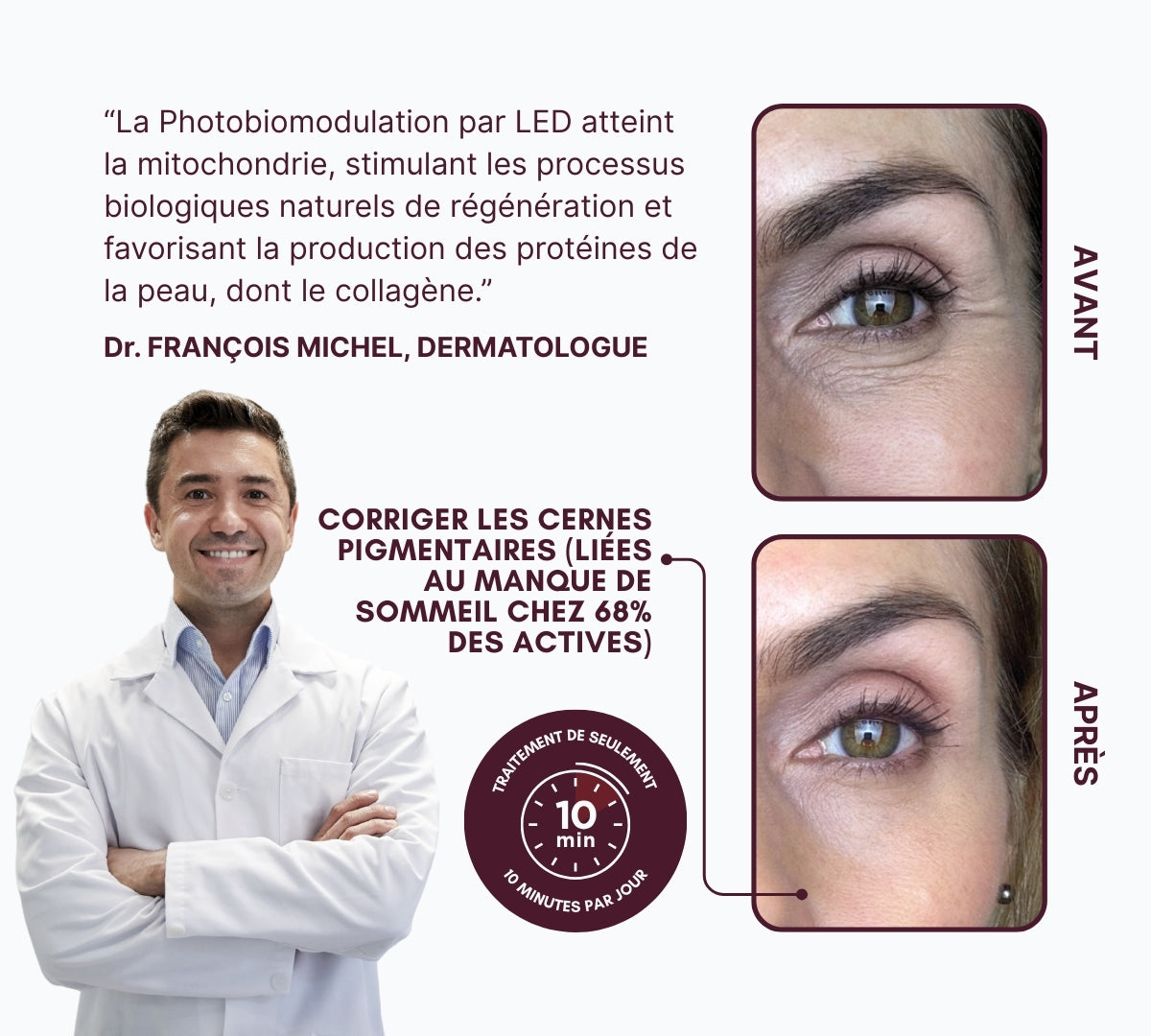 EYESCULPT PRO